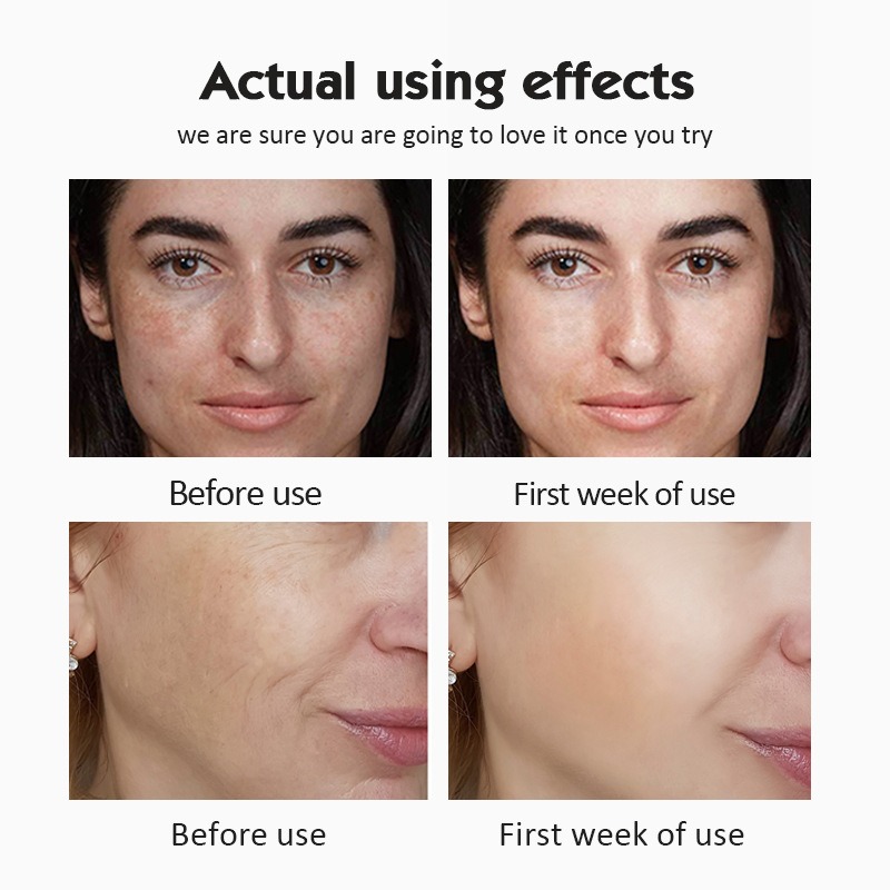20% Vitamin C Ampoule Serum Se - Luxury Skincare Wholesale recension och pris