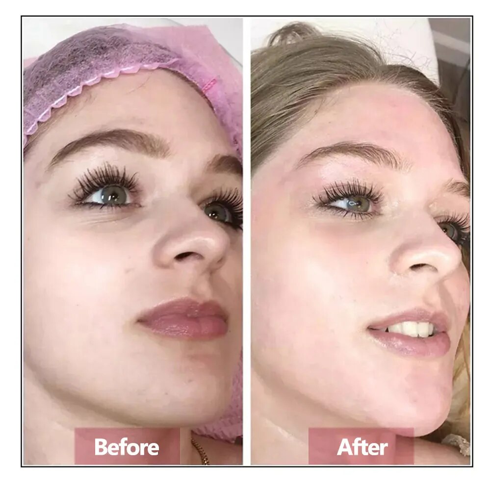 Hyaluronic Acid Face Serum Ess - Luxury Skincare Wholesale recension och pris
