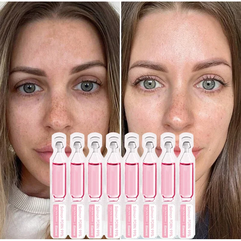 2ml*10 Vials Serum Pdrn Salmon - Luxury Skincare Wholesale recension och pris